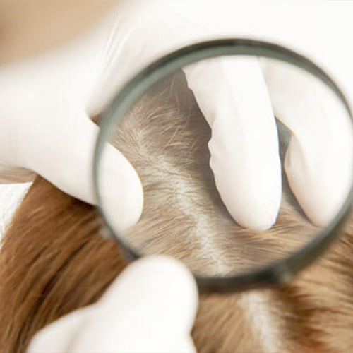 TRICHOLOGY Scalp & Hair Analysis